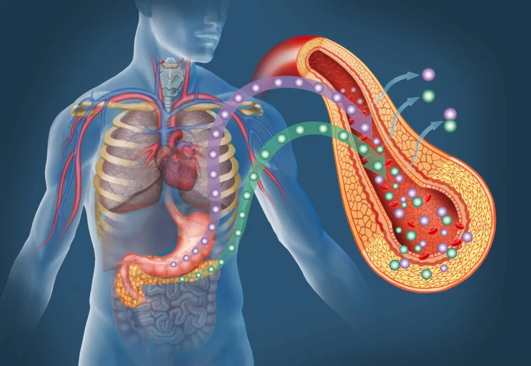 Medical illustration showing how high blood sugar damages retinal blood vessels